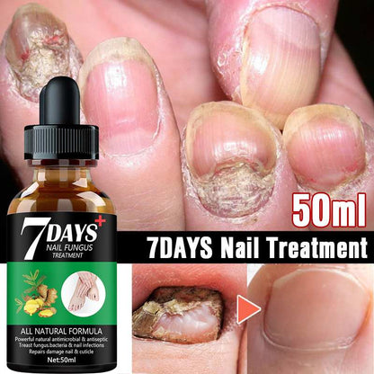 A.A.Y - Natural Nail Fungus Treatment Serum