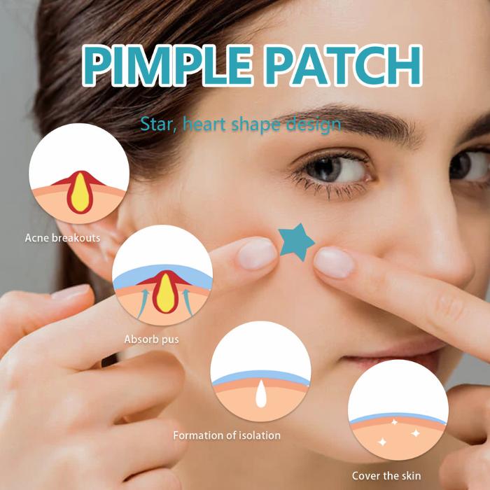 Pimple Patches Hydrocolloid Acne Patch