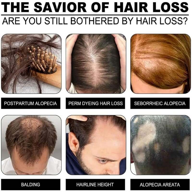 Rice Water Shampoo Bar – Natural Solid Hair Soap for Hydration, Strengthening and Scalp Care,Yiwu Cujia Trade Co., Ltd