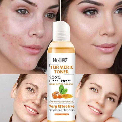 Turmeric Toner Whitening Hydrating Dark Spots Eraser - A.A.Y FASHION